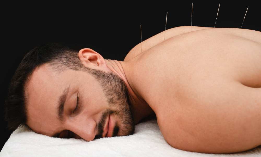 Medical Acupuncture