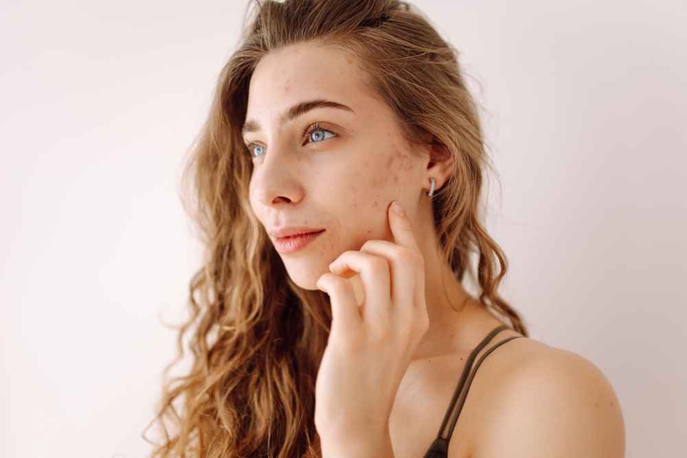 Skincare & Skin Disease Awareness